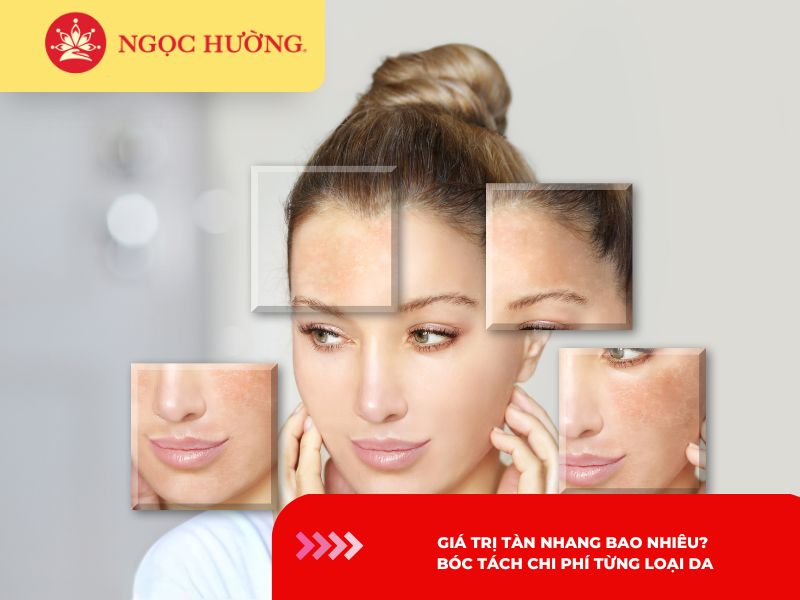 [2026] Giá trị tàn nhang bao nhiêu? Bóc tách chi phí từng loại da