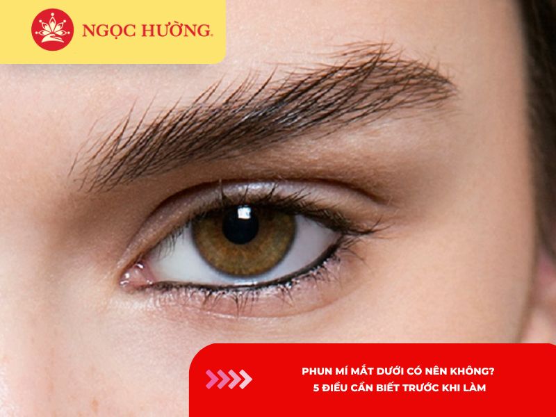 Phun mí mắt dưới có nên không? 5 điều cần biết trước khi làm
