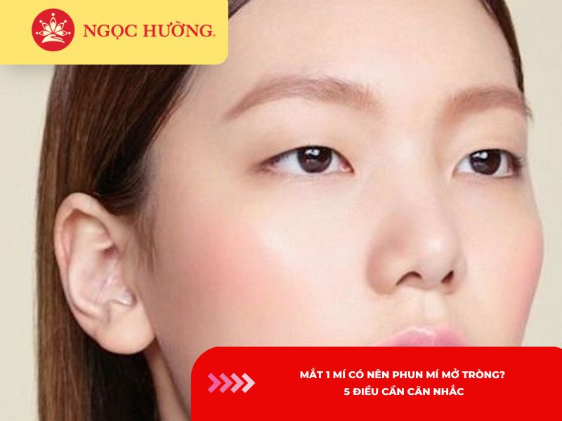 Mắt 1 mí có nên phun mí mở tròng? 5 điều cần cân nhắc