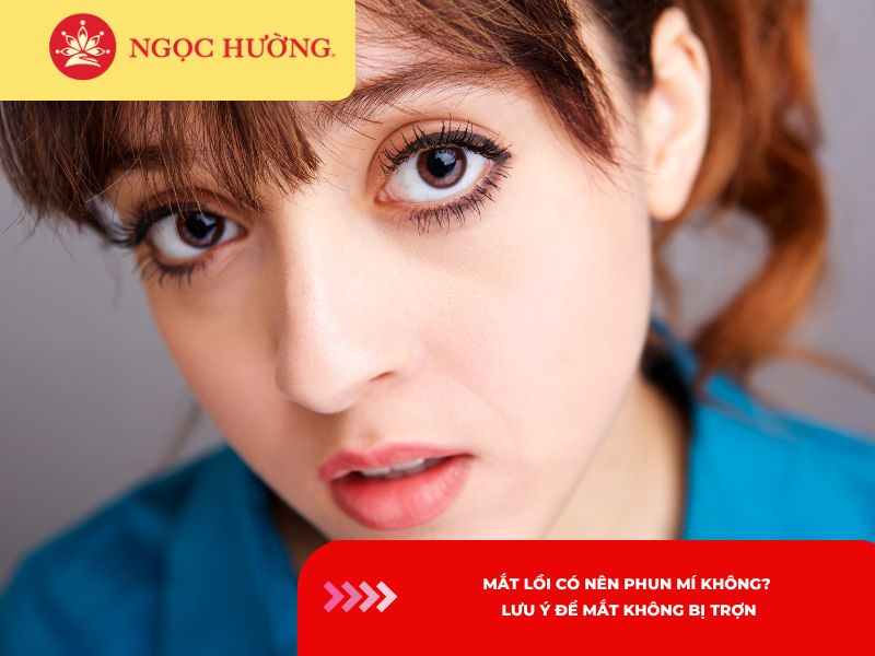 Mắt lồi có nên phun mí không? Lưu ý để mắt không bị trợn