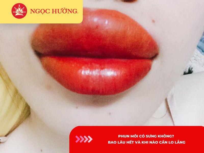 Phun môi có sưng không? Bao lâu hết và khi nào cần lo lắng