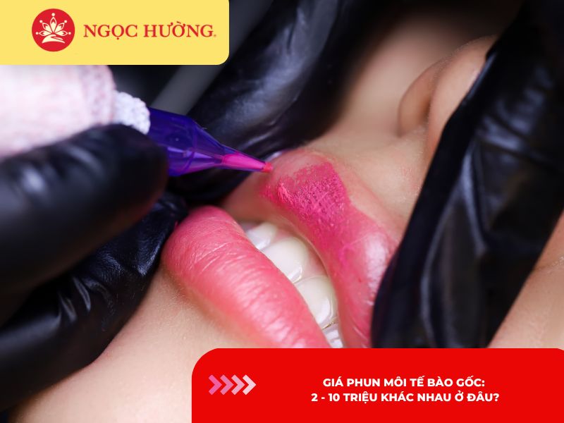 Giá phun môi tế bào gốc: 2–10 triệu khác nhau ở đâu?