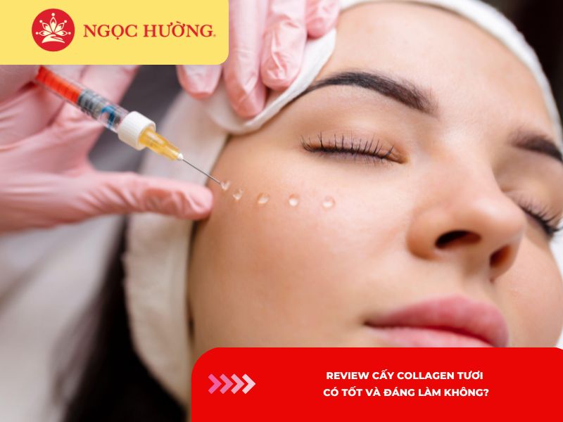 Review cấy collagen tươi: Có tốt và đáng làm không