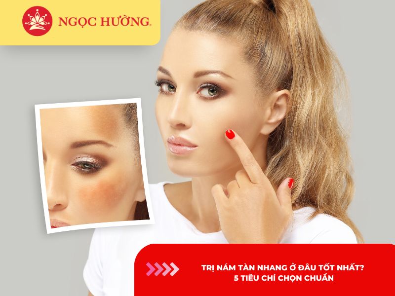 Trị nám tàn nhang ở đâu tốt nhất? 5 tiêu chí chọn chuẩn