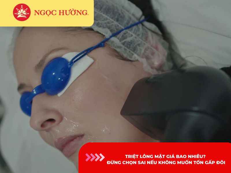 Triệt lông mặt giá bao nhiêu? Đừng chọn sai nếu không muốn tốn gấp đôi