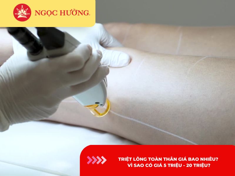 Triệt lông toàn thân giá bao nhiêu? Vì sao có giá 5 triệu - 20 triệu?